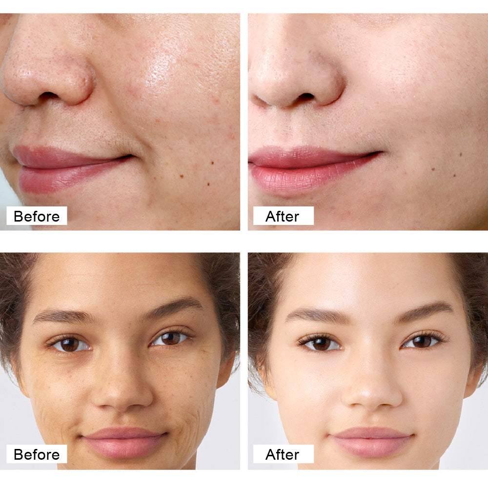 Crema de Retinol Antiarrugas - Vitamina A, C y Arbutina-Doble Potencia